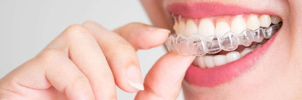 How to use Invisalign cleaning crystals? 