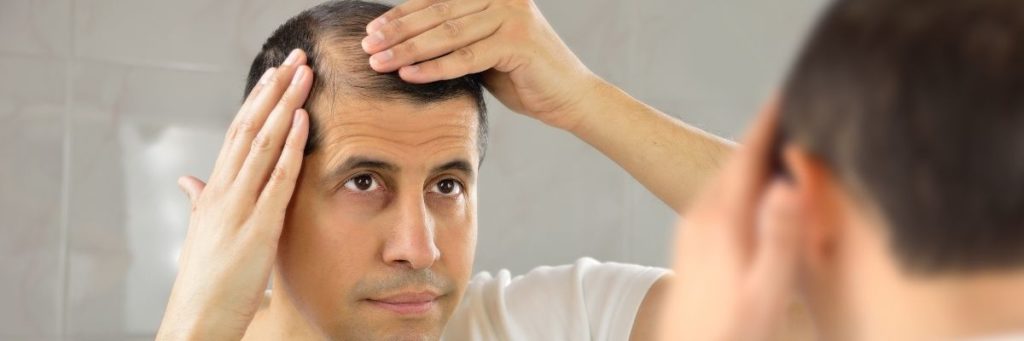 What is the best age to undergo a hair transplant?