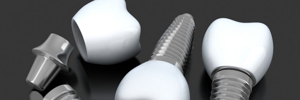 What are dental implants made of?