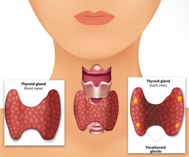 What Is Parathyroid Disease Symptoms Causes And Treatments Healthgree