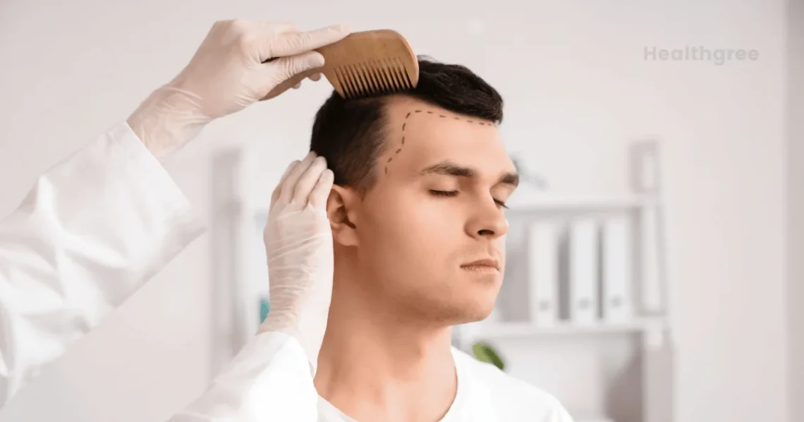 What Age Is Best For A Hair Transplant
