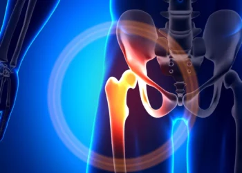 Robotic vs Traditional Hip Replacement - 10 Reasons Patients Prefer Robotic Precision