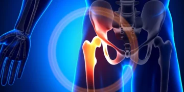 Robotic vs Traditional Hip Replacement - 10 Reasons Patients Prefer Robotic Precision