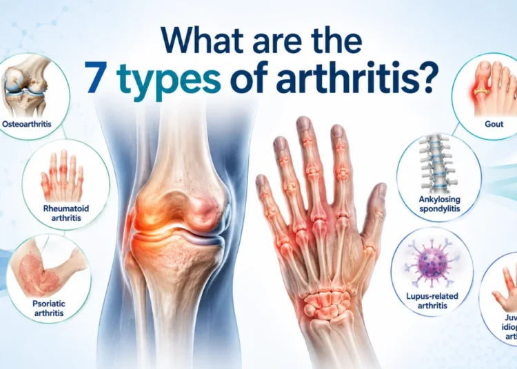 What are the 7 types of arthritis